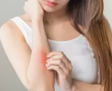 Home Remedies for Itchy Skin