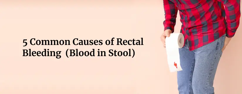 Rectal Bleeding Causes