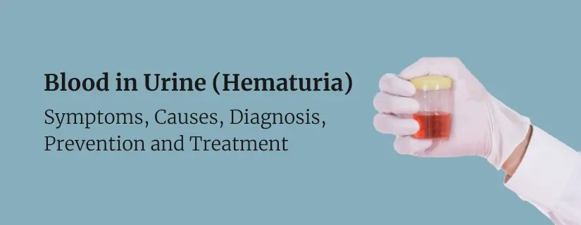 Blood in Urine (Hematuria) 