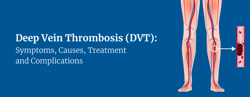 Deep vein Thrombosis