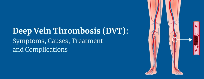 Deep vein Thrombosis