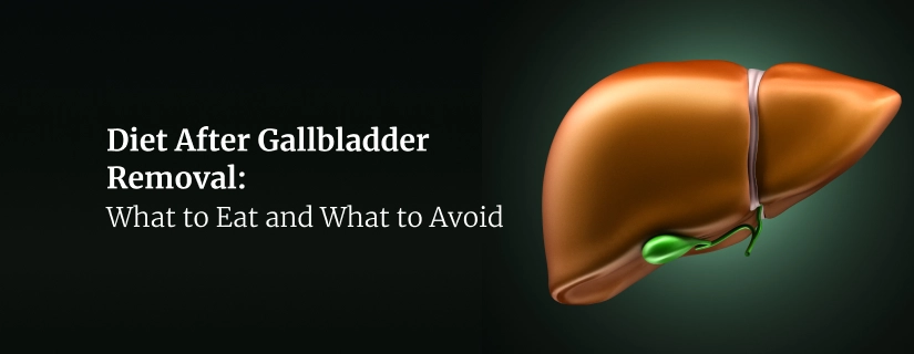 Diet After Gallbladder Removal: What to Eat and What to Avoid