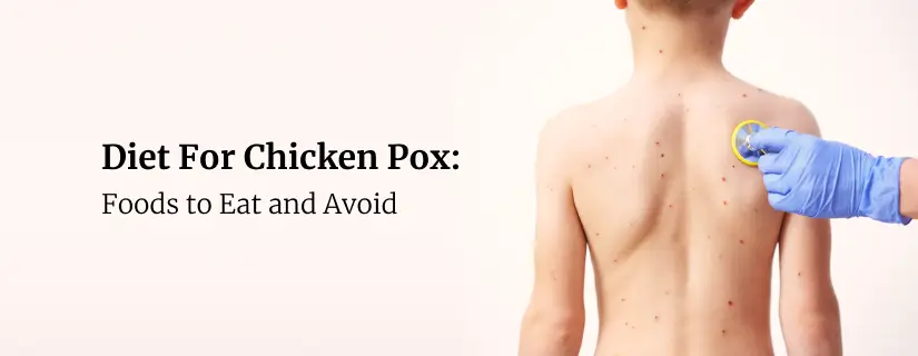 Diet For Chicken Pox