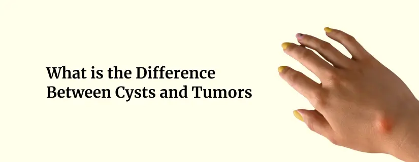 Difference Between Cysts and Tumors