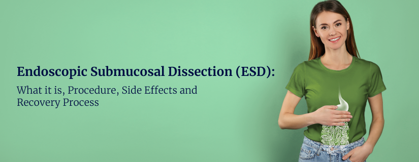 Endoscopic Submucosal Dissection (ESD)