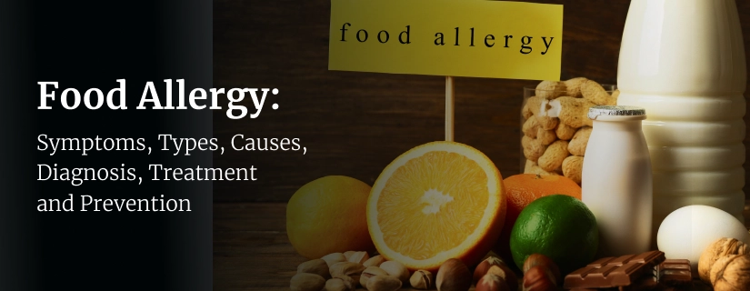 Green Tea Allergy: Symptoms, Causes, Diagnosis