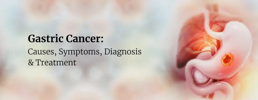 Gastric Cancer