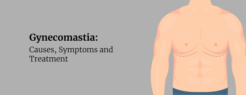 Gynecomastia