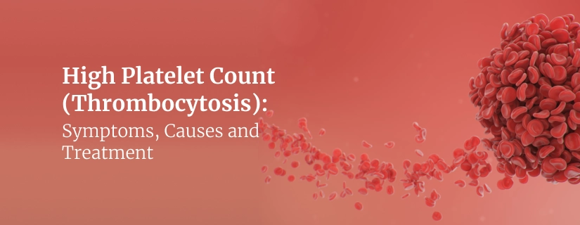 High Platelet Count (Thrombocytosis)