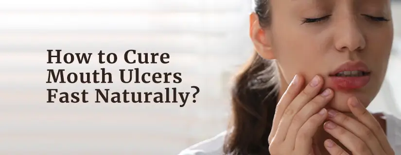 How to Cure Mouth Ulcers Fast Naturally