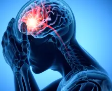 Idiopathic Intracranial Hypertension