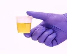 Ketones in urine