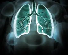 Lung Cancer Screening