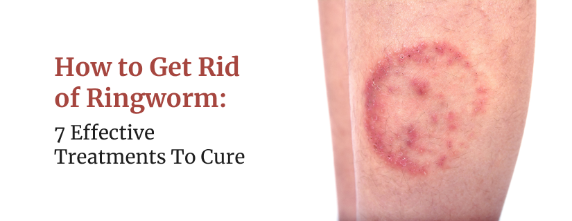 Red Spots on Skin: Causes, Treatment, Prevention Tips (2024)
