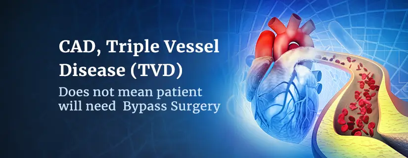 CAD, Triple Vessel Disease (TVD)