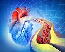 CAD, Triple Vessel Disease (TVD)