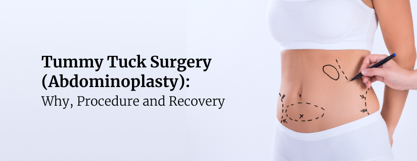 Tummy Tuck Surgery