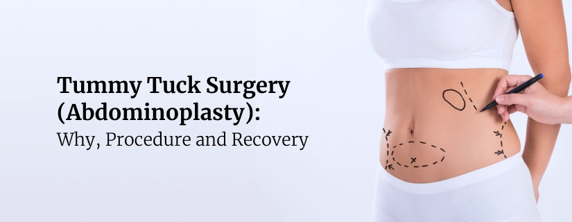 Tummy Tuck Surgery