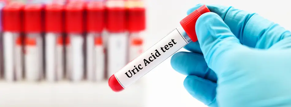 How to Lower Uric Acid Levels