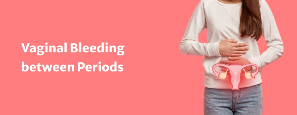 Vaginal Bleeding between Periods: Causes, Diagnosis, Prevention and  Treatment
