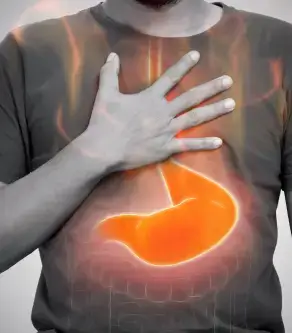 Home Remedies for Acid Reflux