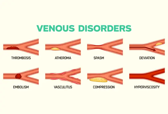 Acute venous disorder