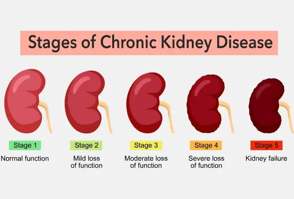 chronic-kidney-disease