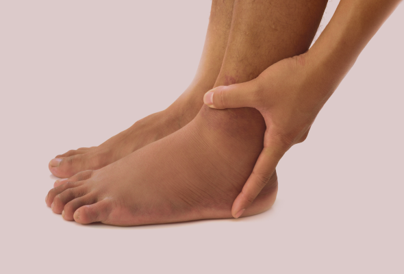 Swollen Feet and Ankles: 16 Causes, Treatments, Pregnancy