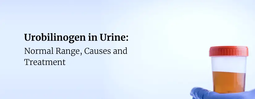 Urobilinogen in Urine