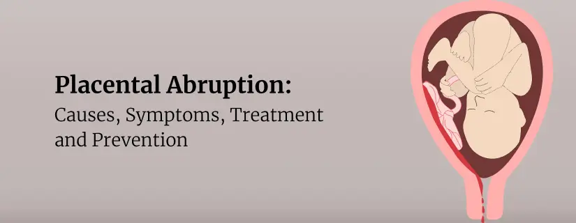 Placental Abruption